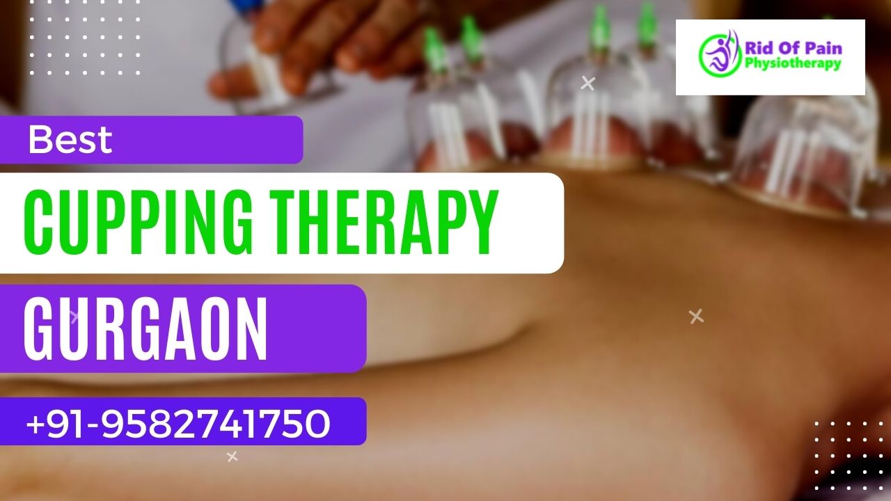 You are currently viewing Cupping Therapy in Gurgaon | Rid of Pain Physiotherapy Clinic