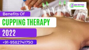Read more about the article Benefits Of Cupping Therapy | Cupping Therapy Physiotherapy Treatments